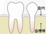 歯周病・歯槽膿漏1　健康な歯肉